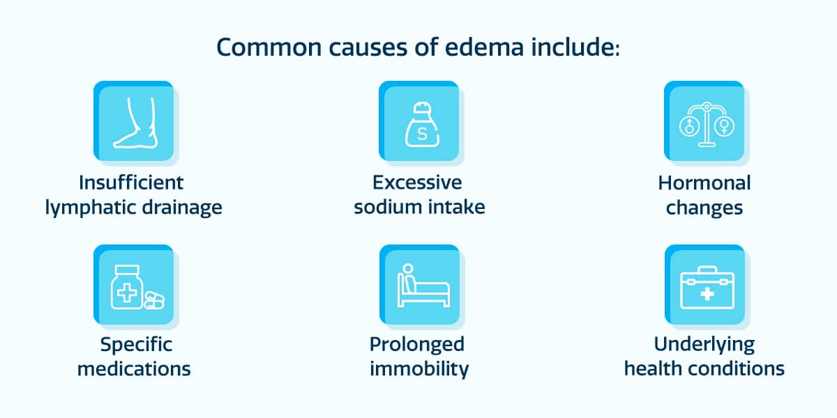 Edema Causes