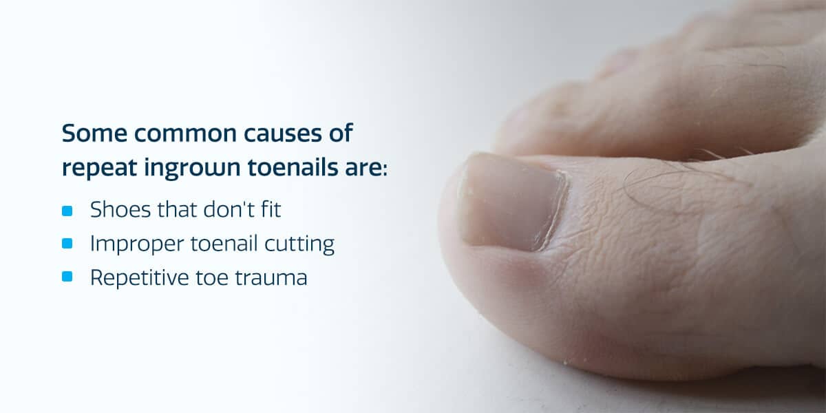 Why do I get Ingrown Toenails? Causes & Treatment Options - The Orthopaedic  Foot & Ankle Center