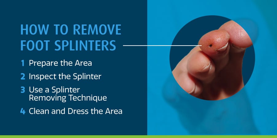 How to Remove Foot Splinters