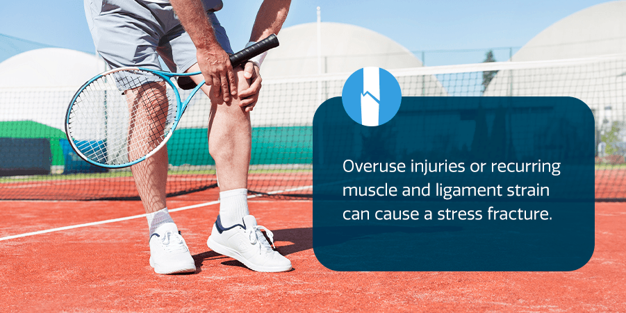 Overuse injuries or recurring muscle and ligament strain can cause a stress fracture.