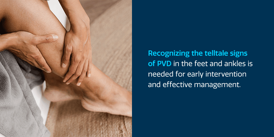 Peripheral Vascular Disease and Poor Circulation in Legs: Are they related?  - Peripheral Vascular Associates