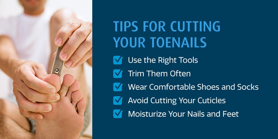 Tips for Cutting Your Toenails