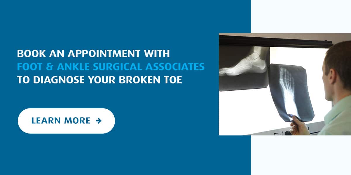Book an Appointment With Foot & Ankle Surgical Associates to Diagnose Your Broken Toe