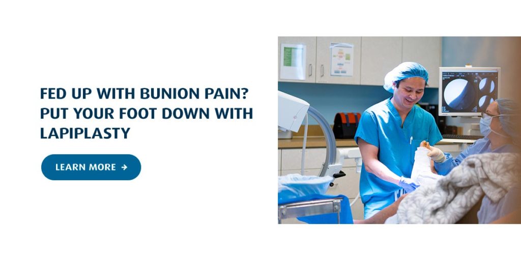 podiatrists performing lapiplasty for patient with bunion pain