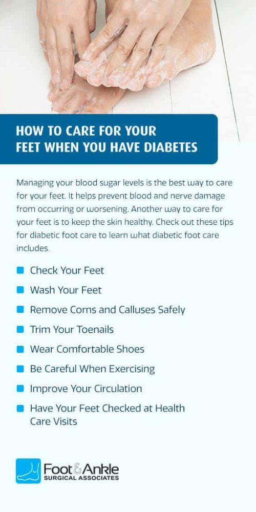 Diabetes Foot Care: 10 Steps to Healthy Feet - HealthXchange