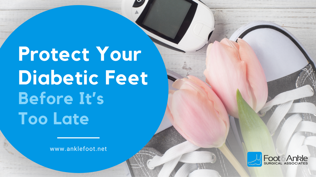 Protect Your Diabetic Feet - Before It's Too Late